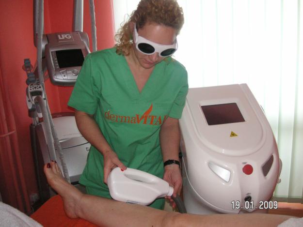 Epilare definitiva-IPL - Pret | Preturi Epilare definitiva-IPL