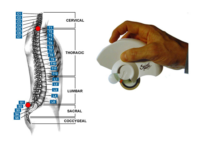 Vindem dispozitiv de evaluare a coloanei vertebrale fara iradiere - Pret | Preturi Vindem dispozitiv de evaluare a coloanei vertebrale fara iradiere