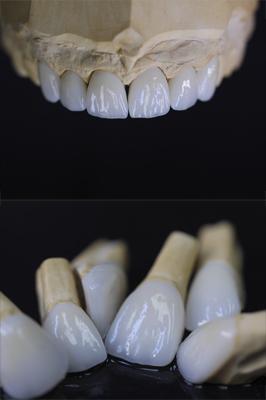 Laborator dentar Oradea - Art Dent - Pret | Preturi Laborator dentar Oradea - Art Dent