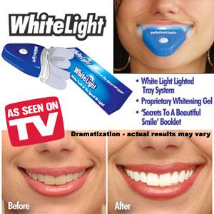 Albirea dintilor, dinti albi, WHITE LIGHT ™, albit dintii - Pret | Preturi Albirea dintilor, dinti albi, WHITE LIGHT ™, albit dintii