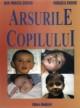 Arsurile copilului - Pret | Preturi Arsurile copilului