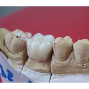 Coroana dentara metalo-ceramica Hera Ceram - Haereus Kultzer - Pret | Preturi Coroana dentara metalo-ceramica Hera Ceram - Haereus Kultzer