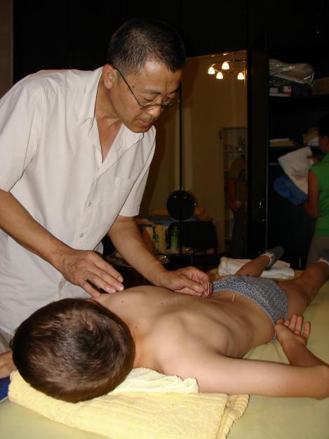 Medic chinez acupunctura - Pret | Preturi Medic chinez acupunctura