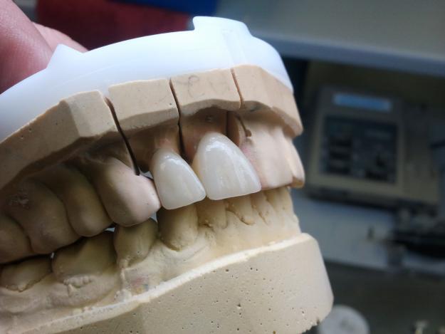 colaborare cu medici dentisti sau clinica dentara - Pret | Preturi colaborare cu medici dentisti sau clinica dentara