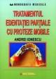 Tratamentul edentaÅ£iei parÅ£iale cu proteze mobile - Pret | Preturi Tratamentul edentaÅ£iei parÅ£iale cu proteze mobile